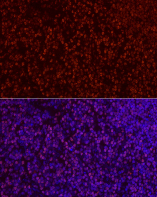 SATB1 Antibody in Immunocytochemistry (ICC/IF)