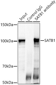 SATB1 Antibody in Immunoprecipitation (IP)