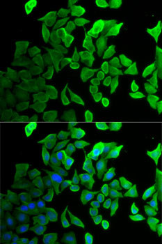 Septin 2 Antibody in Immunocytochemistry (ICC/IF)