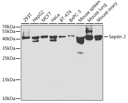 Septin 2 Antibody in Western Blot (WB)