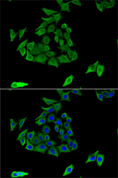 TGM3 Antibody in Immunocytochemistry (ICC/IF)