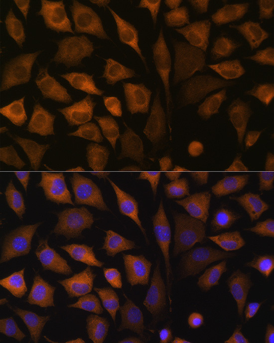 SND1 Antibody in Immunocytochemistry (ICC/IF)