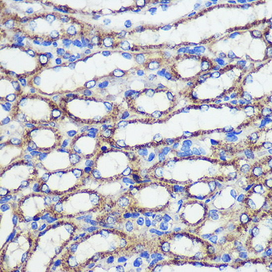 SND1 Antibody in Immunohistochemistry (Paraffin) (IHC (P))