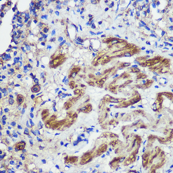 SND1 Antibody in Immunohistochemistry (Paraffin) (IHC (P))