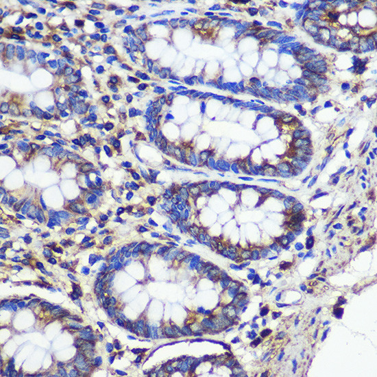 SND1 Antibody in Immunohistochemistry (Paraffin) (IHC (P))