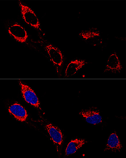 ATP5A1 Antibody in Immunocytochemistry (ICC/IF)