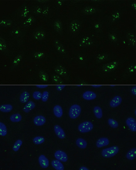 NOLC1 Antibody in Immunocytochemistry (ICC/IF)