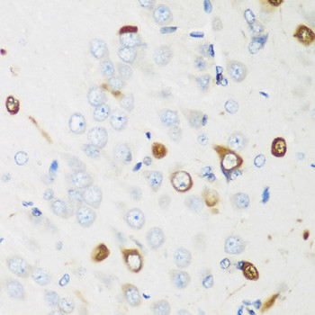 ELAVL2 Antibody in Immunohistochemistry (Paraffin) (IHC (P))