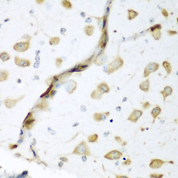 ELAVL2 Antibody in Immunohistochemistry (Paraffin) (IHC (P))