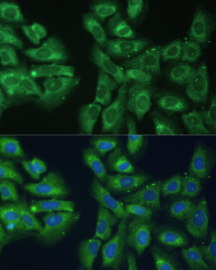 eIF3d Antibody in Immunocytochemistry (ICC/IF)