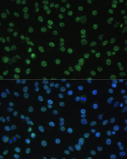 ALY Antibody in Immunocytochemistry (ICC/IF)