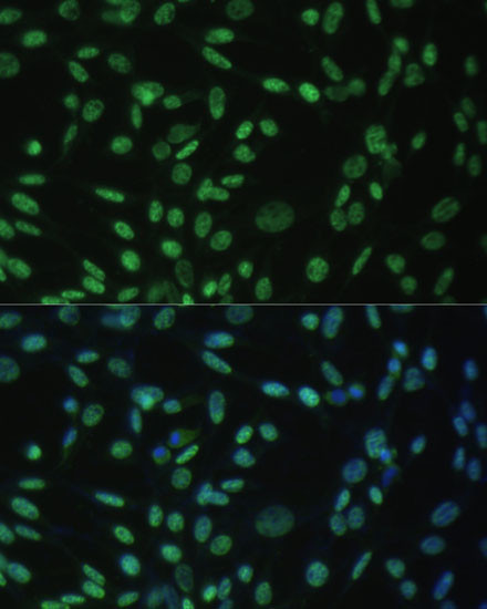 ALY Antibody in Immunocytochemistry (ICC/IF)