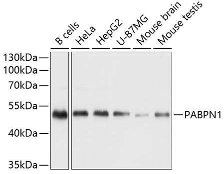 PABPN1 Antibody in Western Blot (WB)
