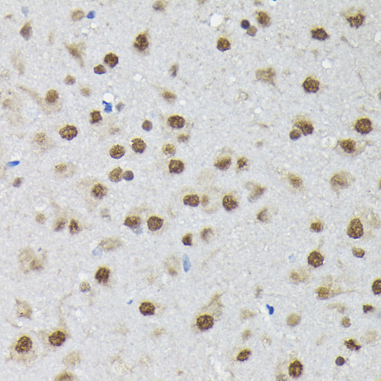 PTBP2 Antibody in Immunohistochemistry (Paraffin) (IHC (P))