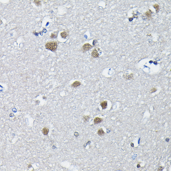 PTBP2 Antibody in Immunohistochemistry (Paraffin) (IHC (P))