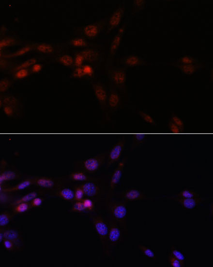 SRSF3 Antibody in Immunocytochemistry (ICC/IF)