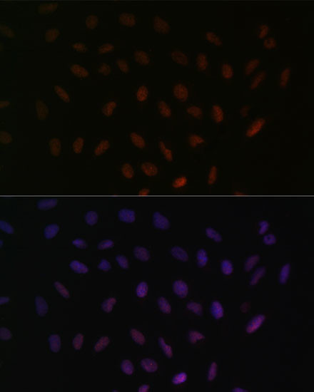 SRSF3 Antibody in Immunocytochemistry (ICC/IF)