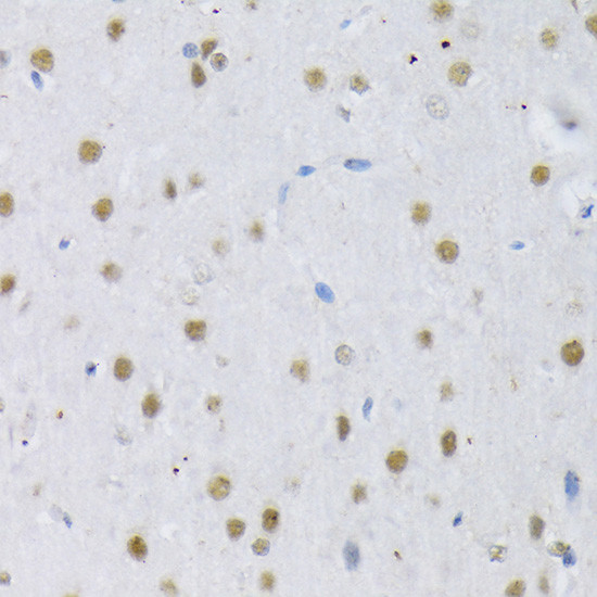 SRSF3 Antibody in Immunohistochemistry (Paraffin) (IHC (P))