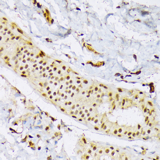 SRSF3 Antibody in Immunohistochemistry (Paraffin) (IHC (P))