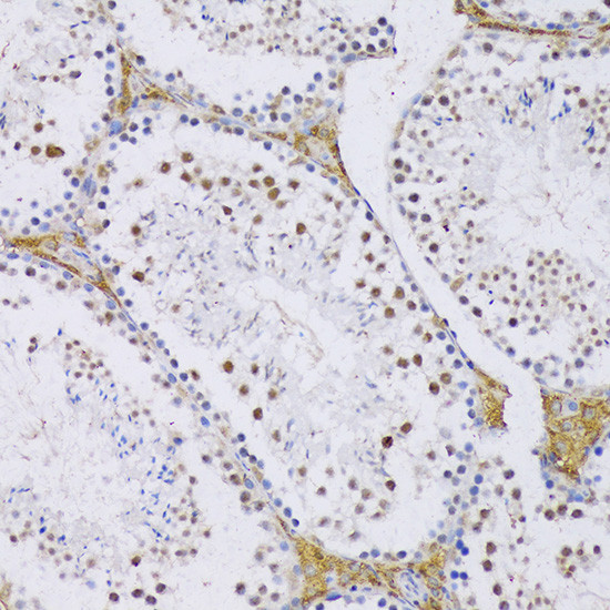 SRSF3 Antibody in Immunohistochemistry (Paraffin) (IHC (P))