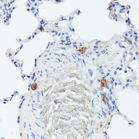 TIAL1 Antibody in Immunohistochemistry (Paraffin) (IHC (P))