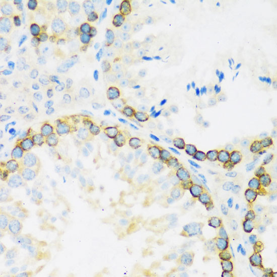 FMRP Antibody in Immunohistochemistry (Paraffin) (IHC (P))