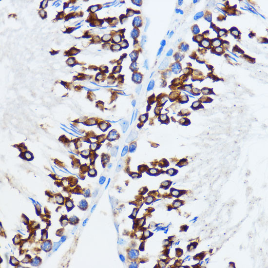 IGF2BP3 Antibody in Immunohistochemistry (Paraffin) (IHC (P))