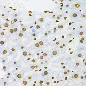 SAM68 Antibody in Immunohistochemistry (Paraffin) (IHC (P))