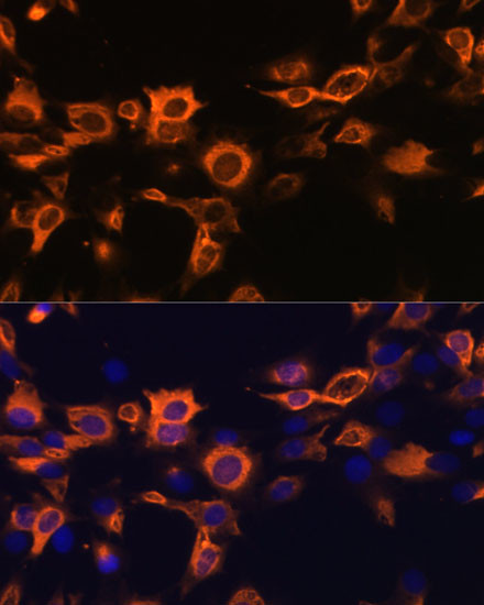 GM-CSF Antibody in Immunocytochemistry (ICC/IF)