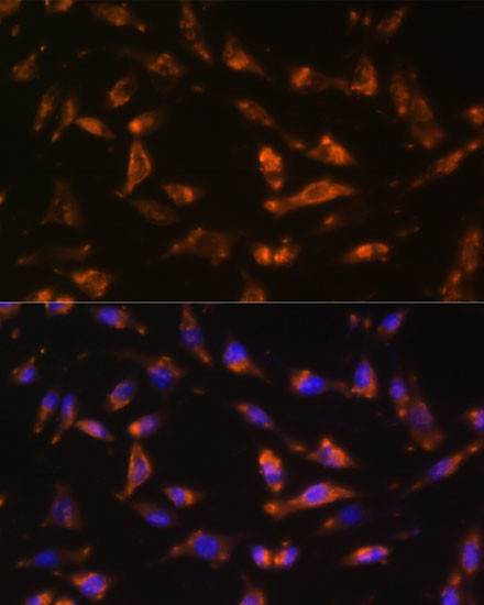 GM-CSF Antibody in Immunocytochemistry (ICC/IF)