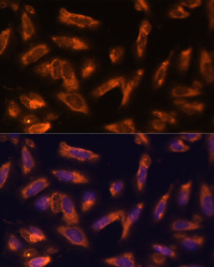 GM-CSF Antibody in Immunocytochemistry (ICC/IF)