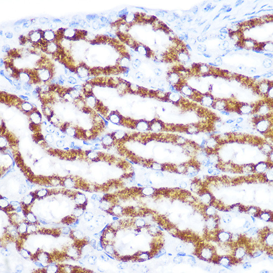 TRAIL-R4 Antibody in Immunohistochemistry (Paraffin) (IHC (P))