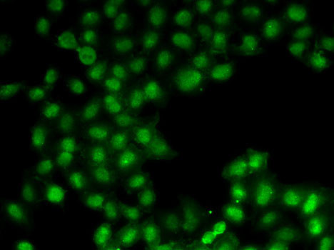 C11orf30 Antibody in Immunocytochemistry (ICC/IF)