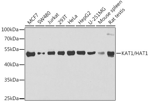 HAT1 Antibody in Western Blot (WB)