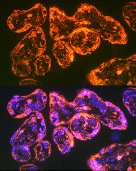 CD49e (Integrin alpha 5) Antibody in Immunohistochemistry (Paraffin) (IHC (P))