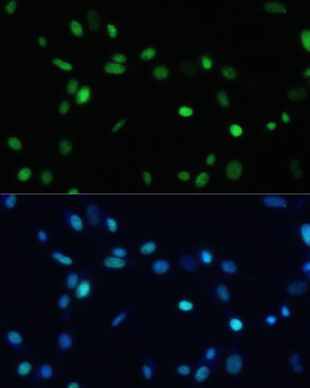 SET Antibody in Immunocytochemistry (ICC/IF)