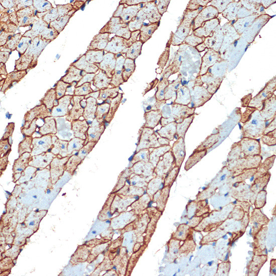 Flotillin 1 Antibody in Immunohistochemistry (Paraffin) (IHC (P))