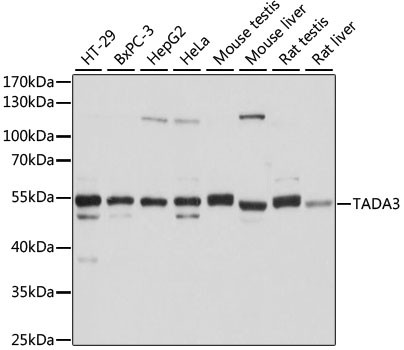 TADA3L Antibody in Western Blot (WB)