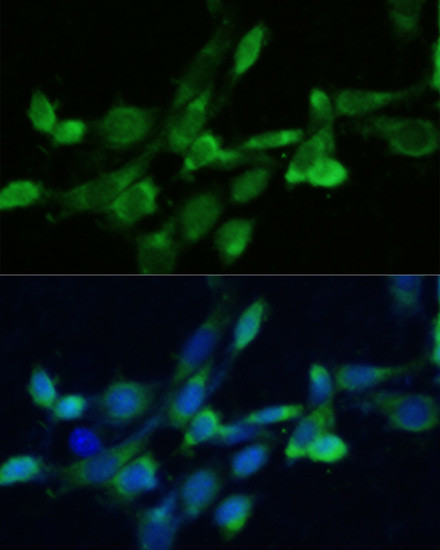 FDFT1 Antibody in Immunocytochemistry (ICC/IF)