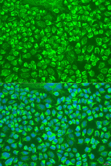 Granzyme A Antibody in Immunocytochemistry (ICC/IF)