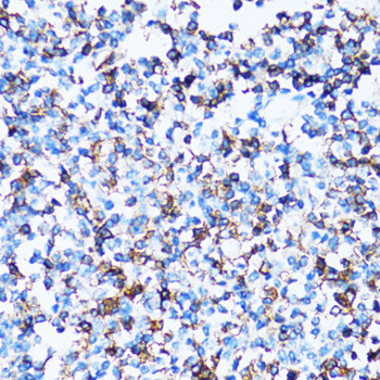 CD43 Antibody in Immunohistochemistry (Paraffin) (IHC (P))