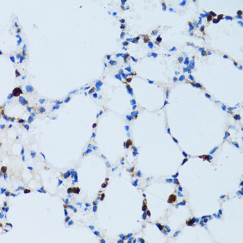 CD43 Antibody in Immunohistochemistry (Paraffin) (IHC (P))