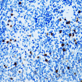 CD43 Antibody in Immunohistochemistry (Paraffin) (IHC (P))