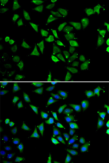 eIF3c Antibody in Immunocytochemistry (ICC/IF)