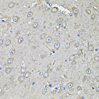 eIF3c Antibody in Immunohistochemistry (Paraffin) (IHC (P))