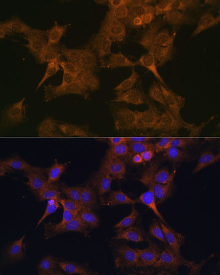 eIF2b beta Antibody in Immunocytochemistry (ICC/IF)