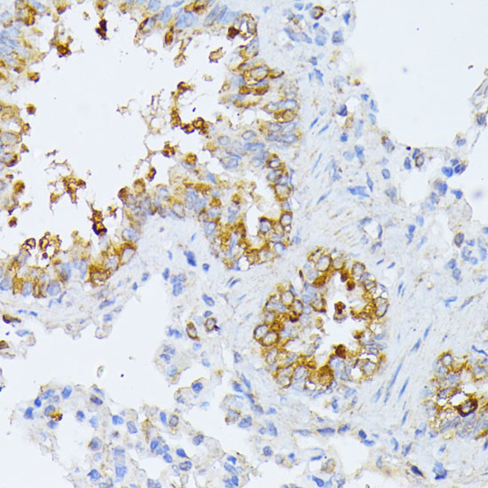 eIF2b beta Antibody in Immunohistochemistry (Paraffin) (IHC (P))