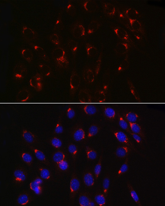 COPB2 Antibody in Immunocytochemistry (ICC/IF)