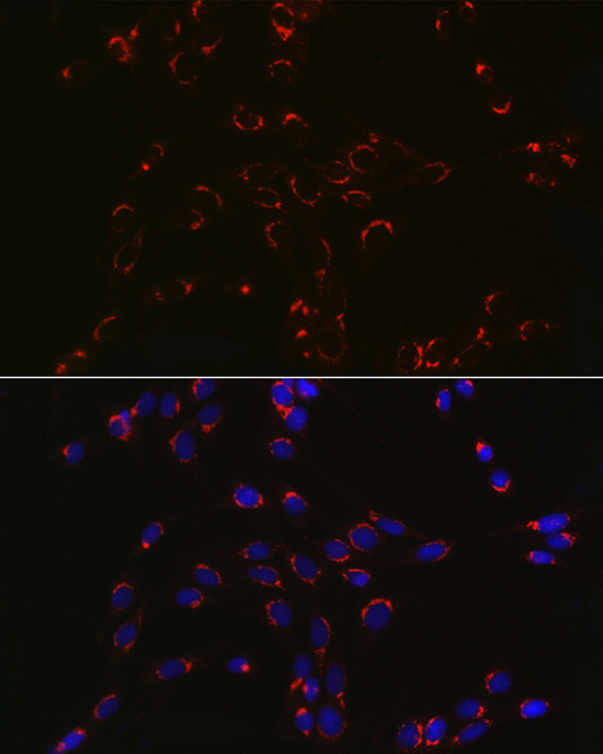 COPB2 Antibody in Immunocytochemistry (ICC/IF)