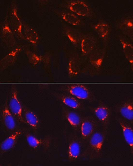 COPB2 Antibody in Immunocytochemistry (ICC/IF)